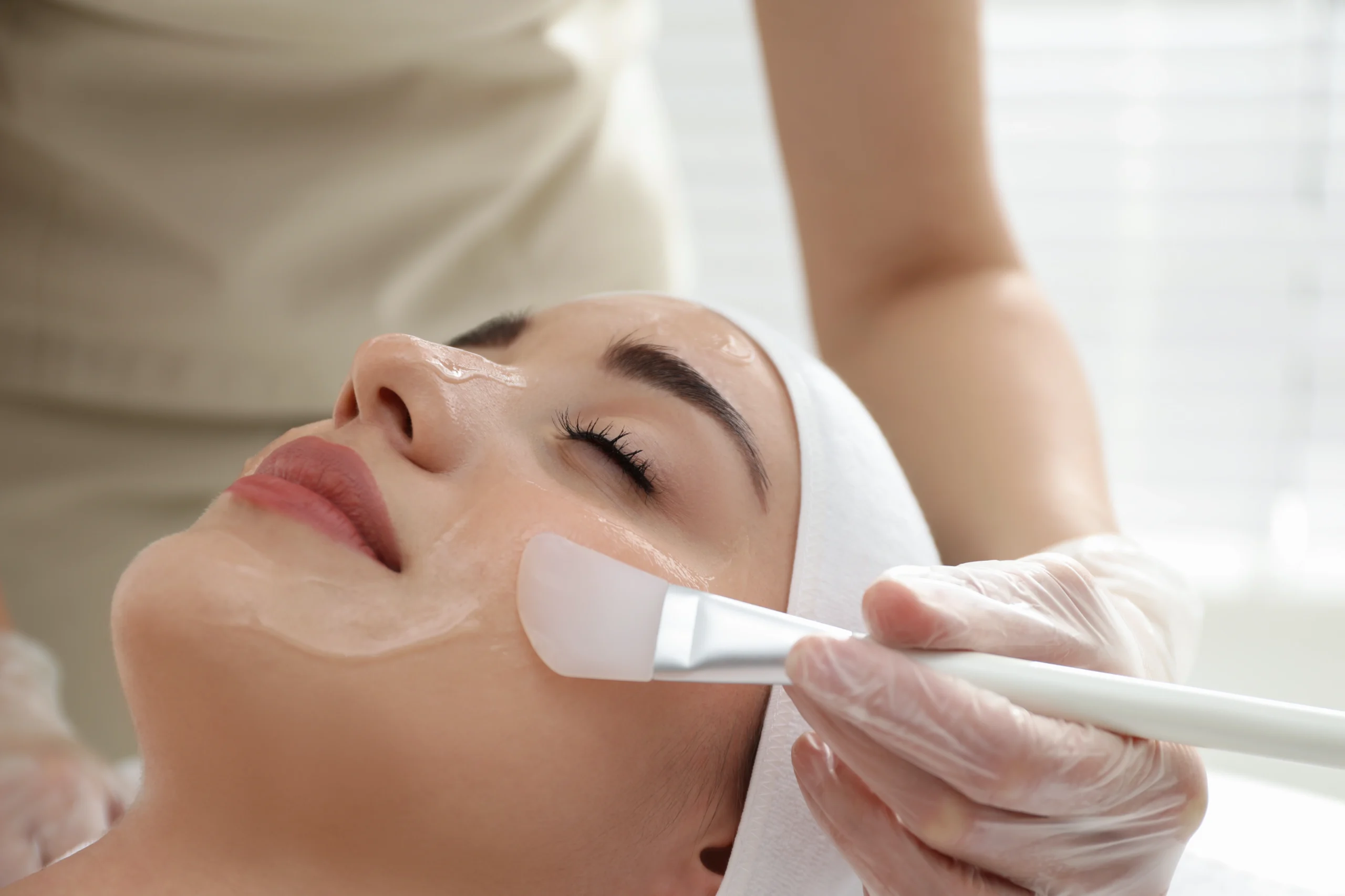 Chemical Peels Treatment | Lotus Aesthetics in Ogden & Farr West Utah