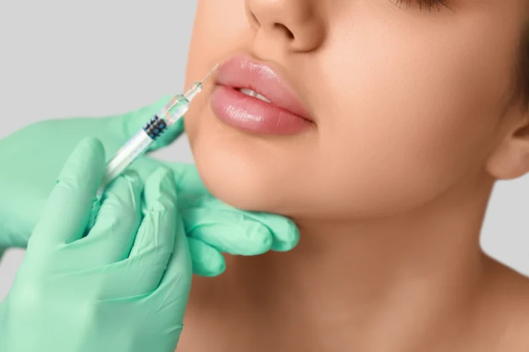 Lip filler injection for natural-looking lip enhancement at Lotus Aesthetics.